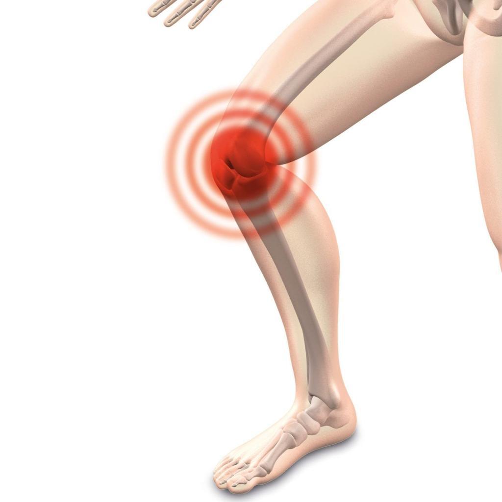 Inflammation du sac avec du liquide synovial, situé à l'intérieur du genou